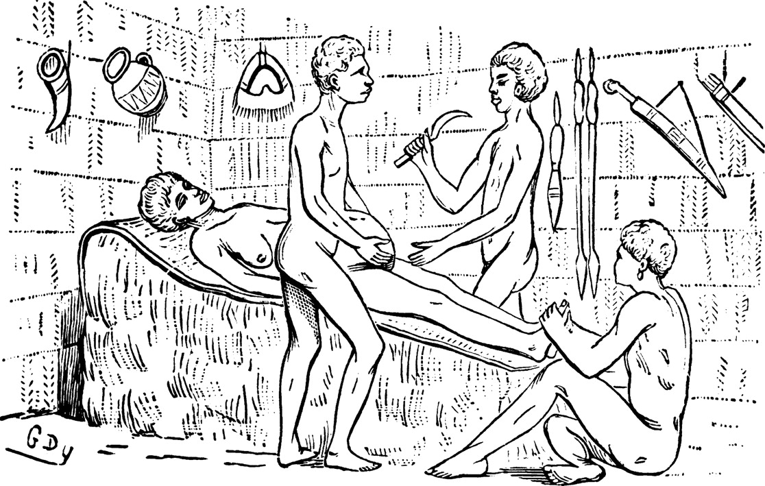 Successful C-Sections in Pre-Colonial Africa: Surgery in Bunyoro Kingdom – African Heritage